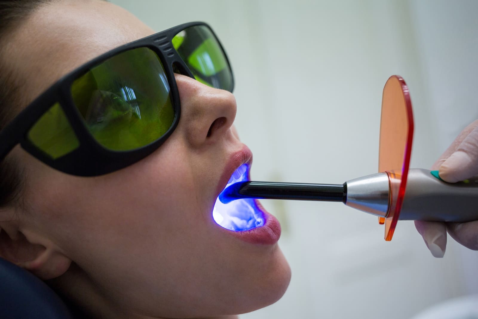 Clareamento Dental